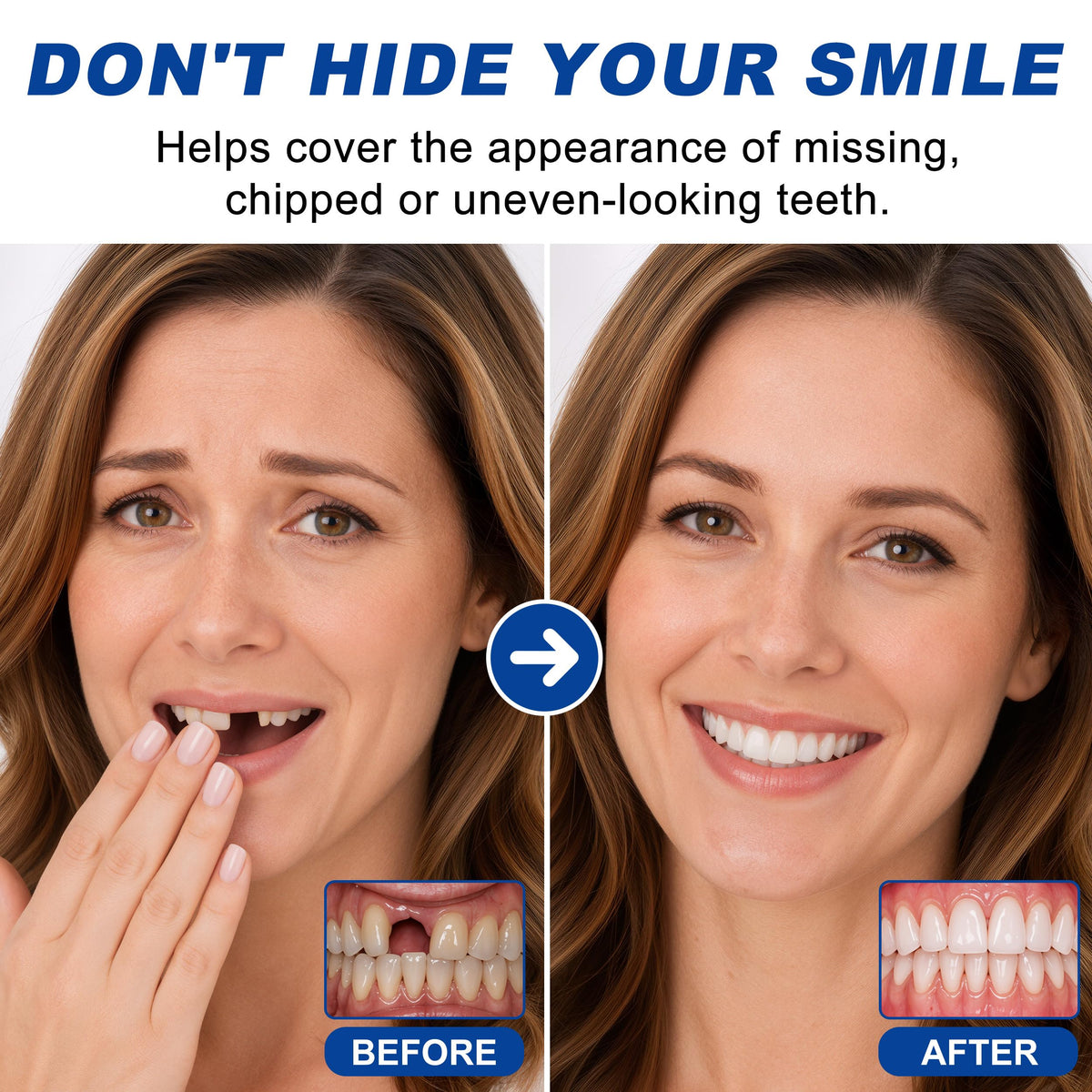 Moldable False Teeth H193298